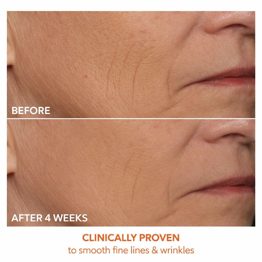 RadianceRX Red Light Mask